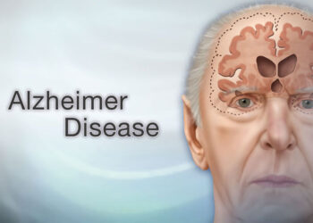 Alzheimer's