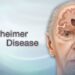 Alzheimer's