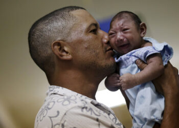 Zika virus affected baby.