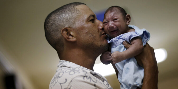 Zika virus affected baby.