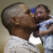 Zika virus affected baby.