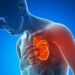 Cardiologists Explain Risks of Myocarditis From COVID Vaccines