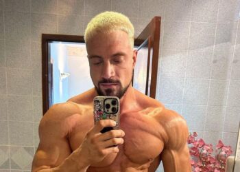 Victory To Tragedy: Unbreakable Spirit Of Jo ‘s Aneurysm Journey